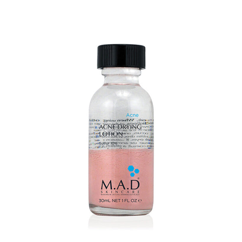 Acne Drying Lotion w Sulfur 10%