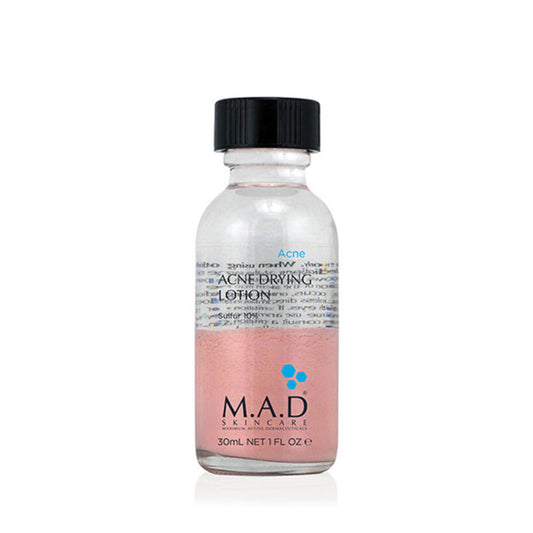 Acne Drying Lotion w Sulfur 10%